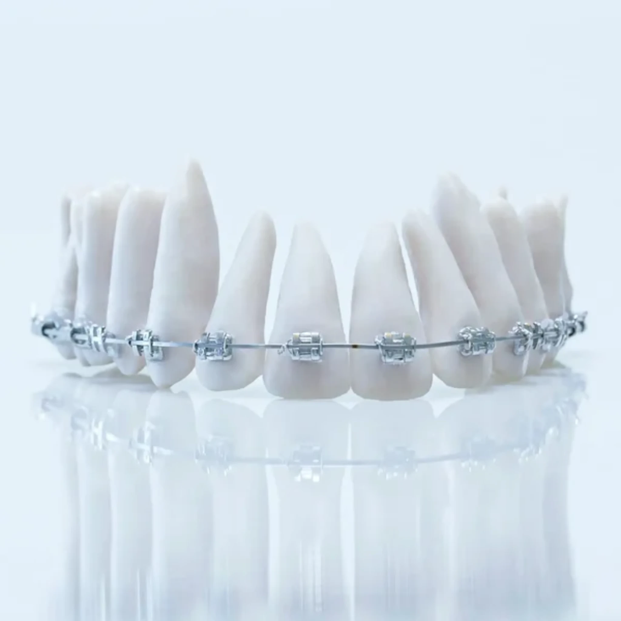 Klowen Custom Orthodontic Solution