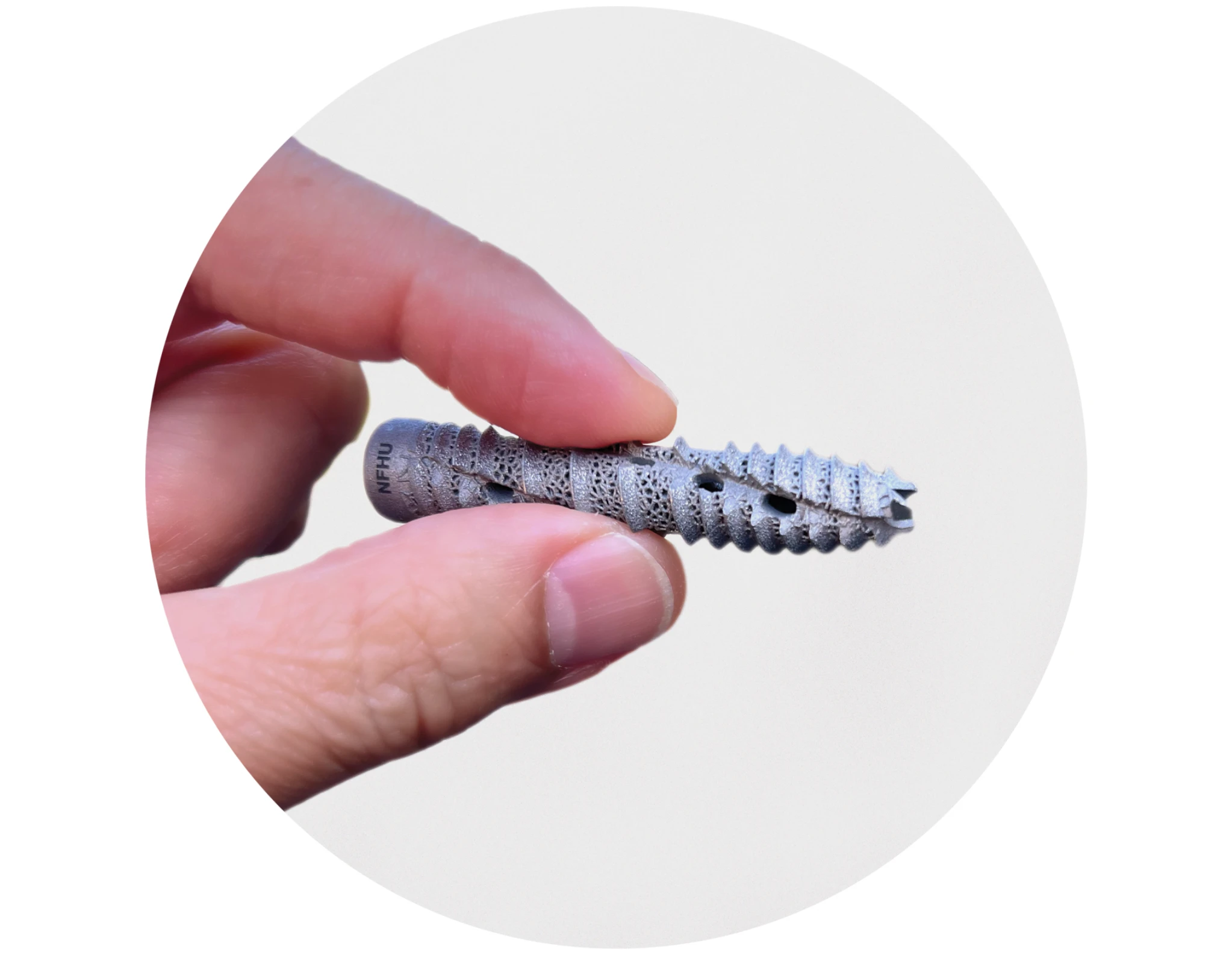 SI-BONE iFuse TORQ Implant System