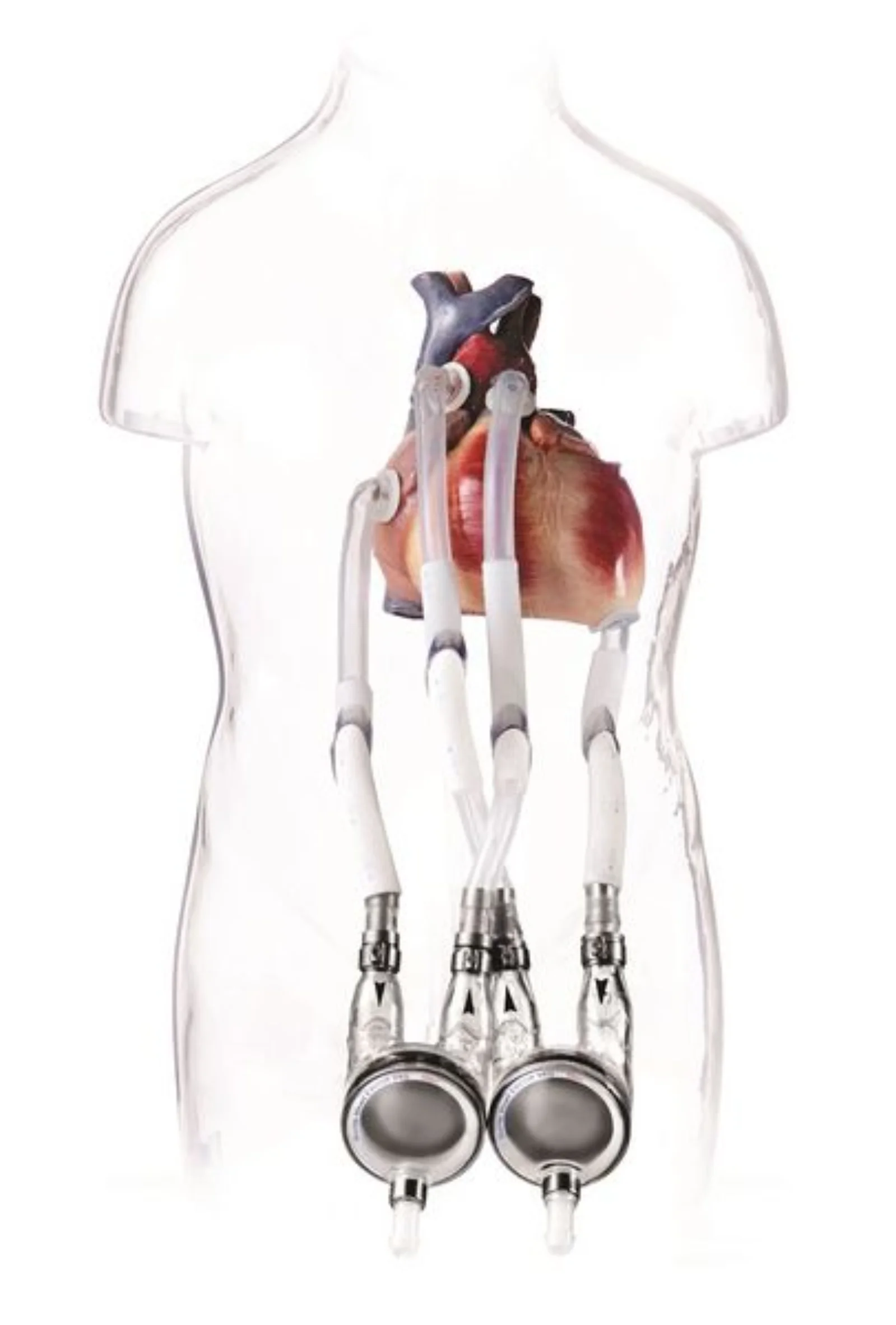 EXCOR Pediatric VAD Blood Pump PU Valves