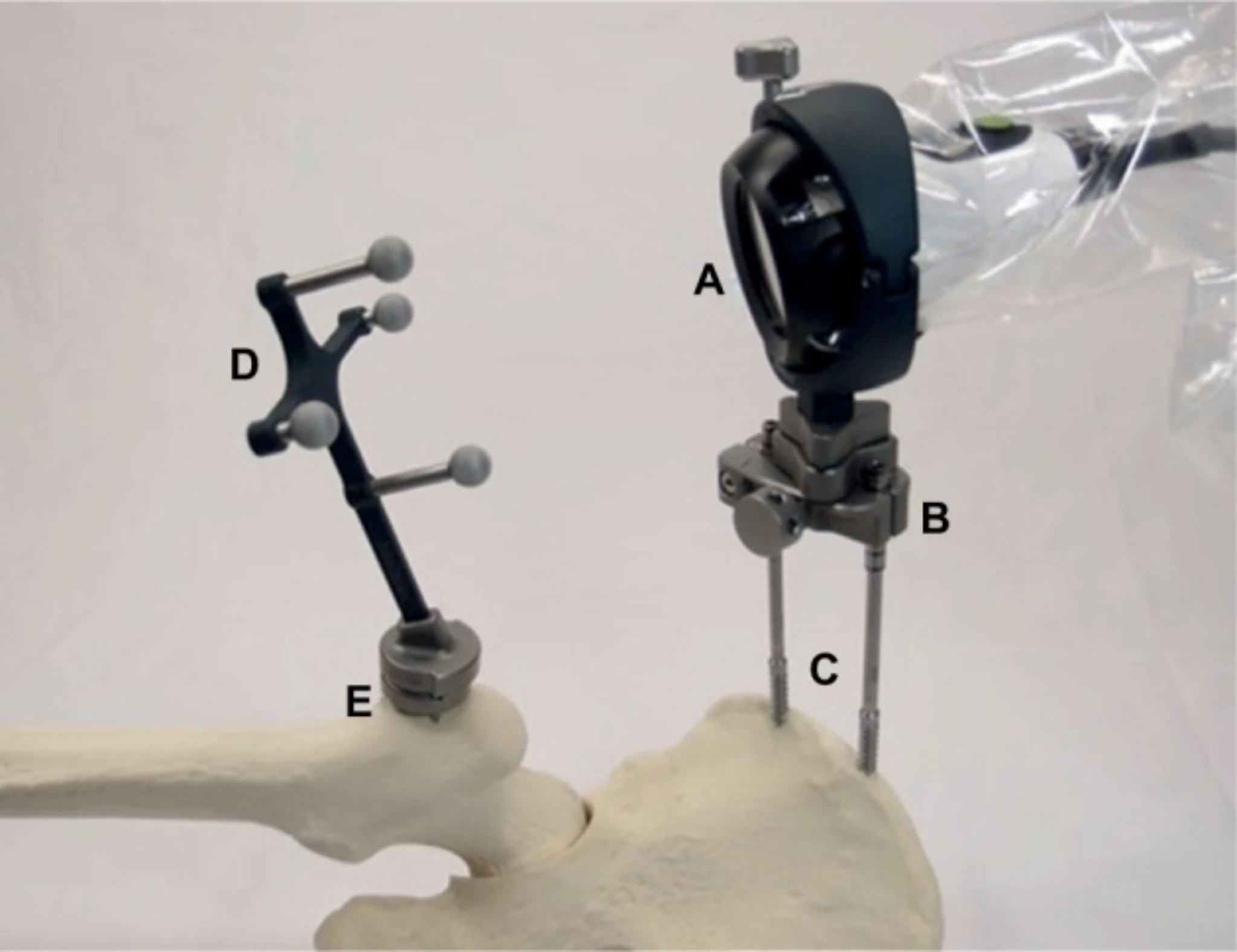 Intellijoint Navigation System and Intellijoint HIP Systems