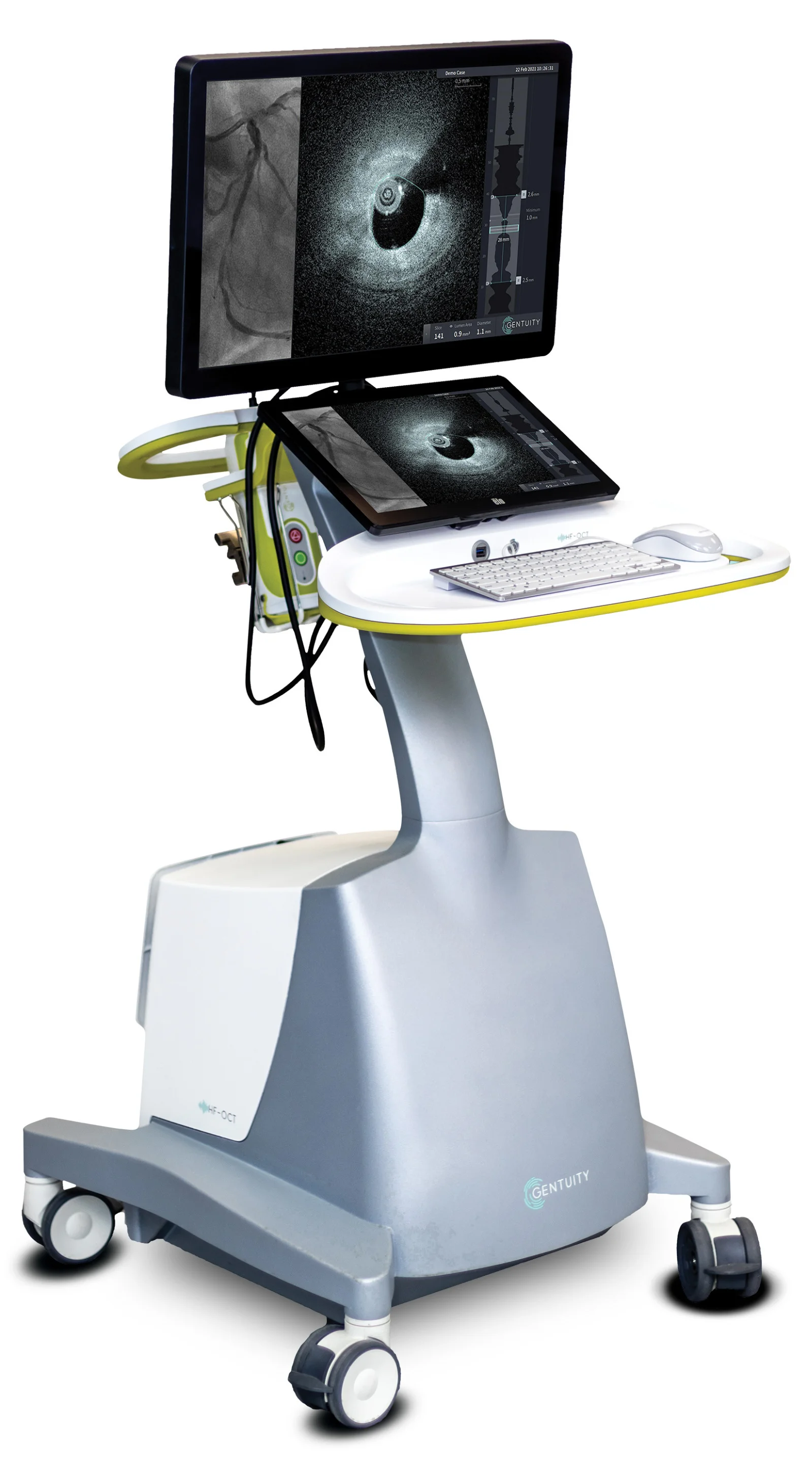 Gentuity HF-OCT Imaging System