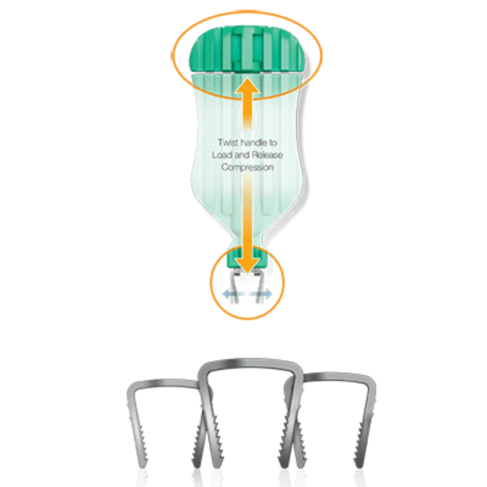 NeoSpan SuperElastic Compression Staple