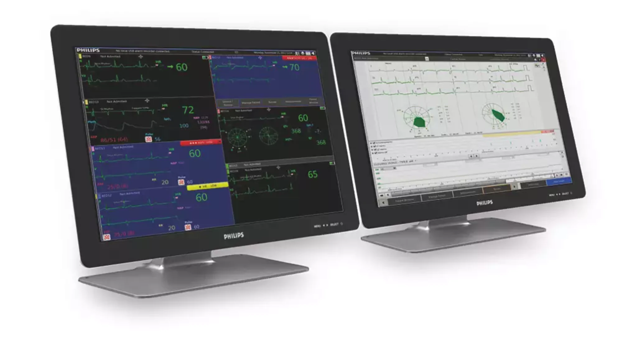 Philips Patient Information Center iX and Philips PIC iX Essentials