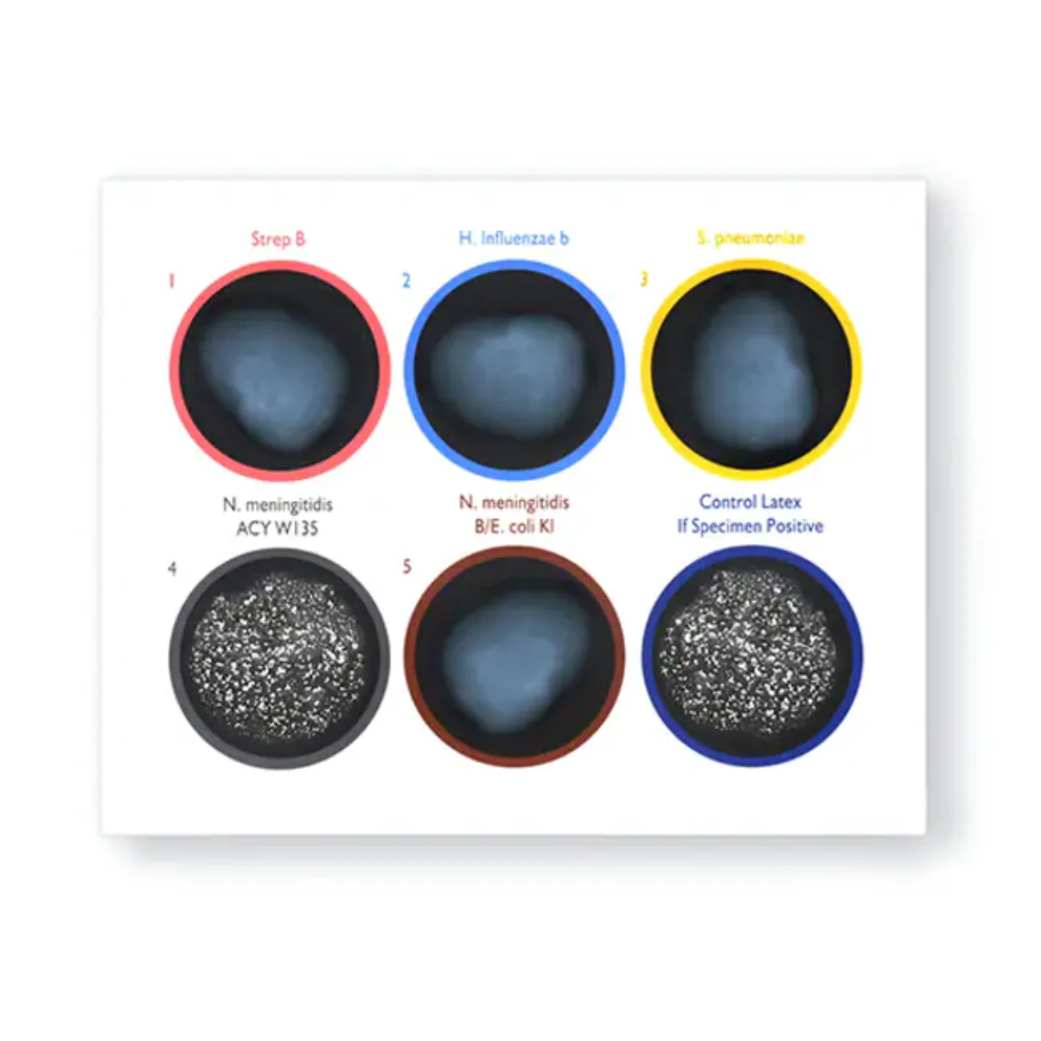 Thermo Fisher Diagnostics Neisseria Meningitidis Gp C Tests