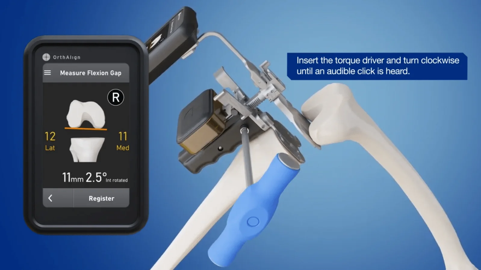 Ortho Dev. Trimax Lantern Knee System Drill Plate