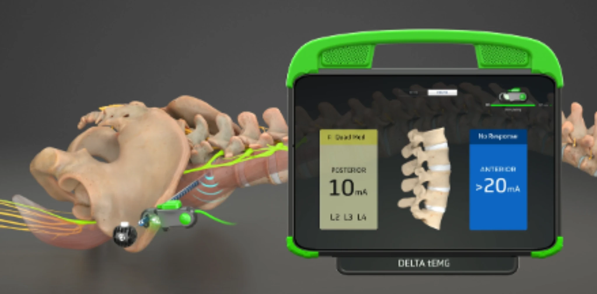 SafeOp Patient Interface