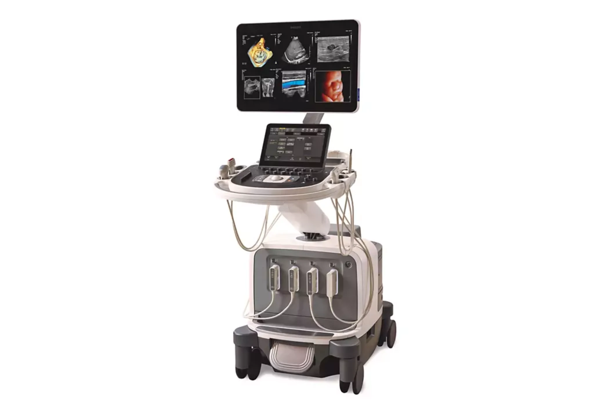 Philips EPIQ Elite Diagnostic Ultrasound System
