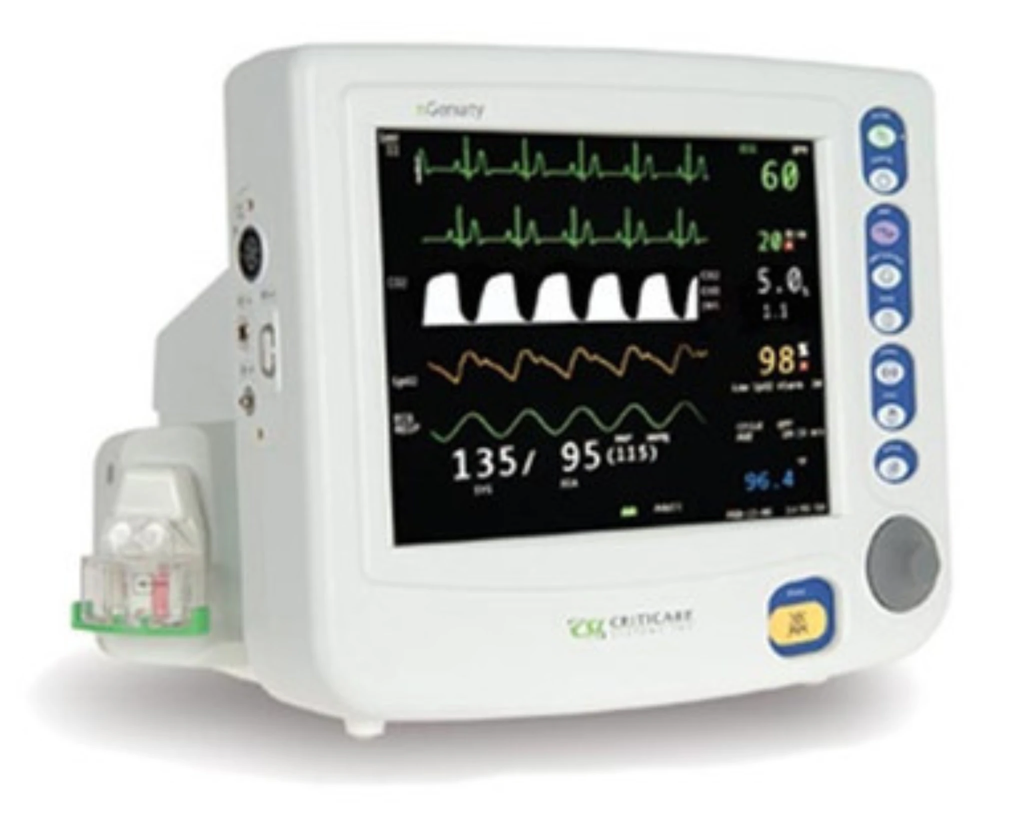 NGenuity Patient Monitor with Capnography (ETCO2)