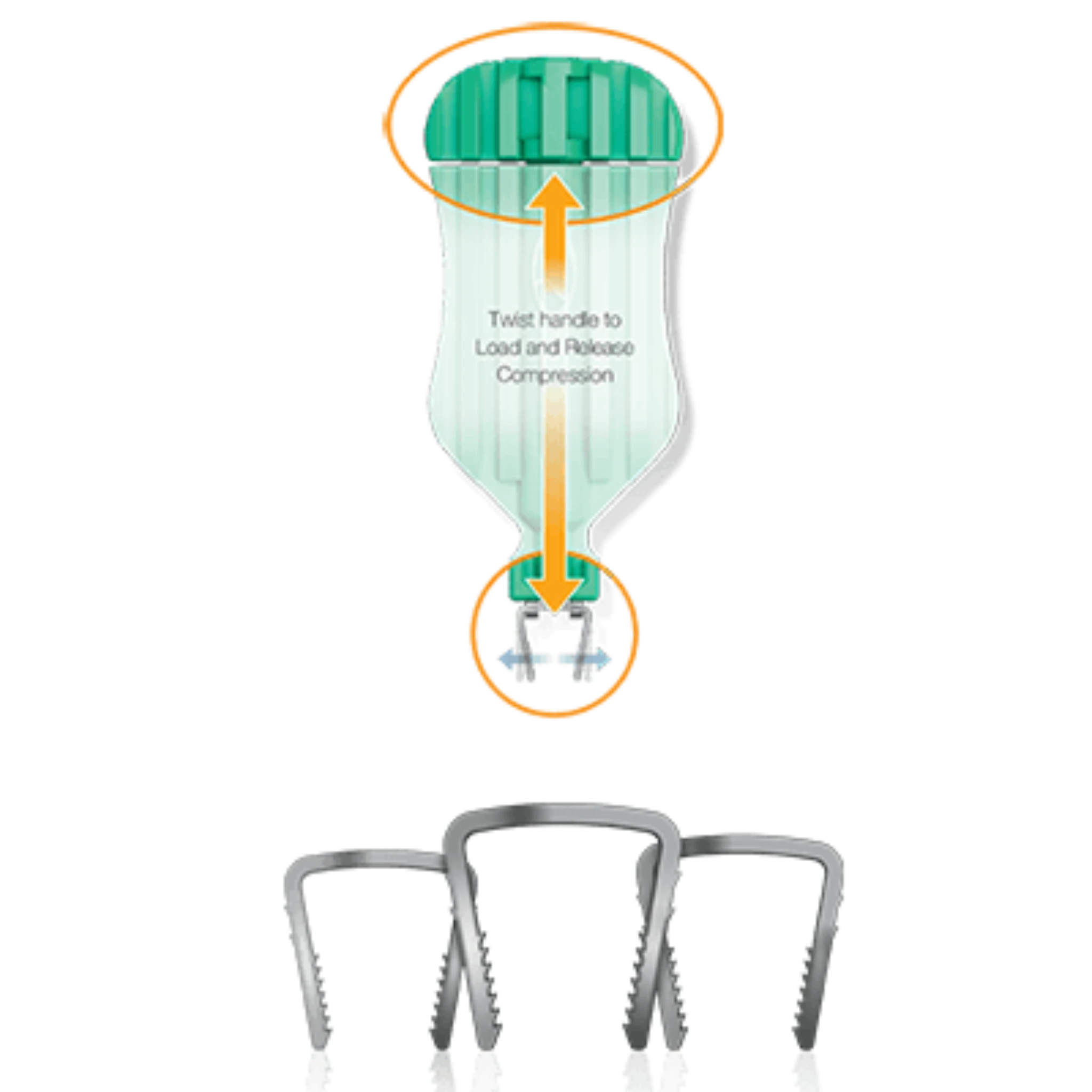 NeoSpan SuperElastic Compression Staple