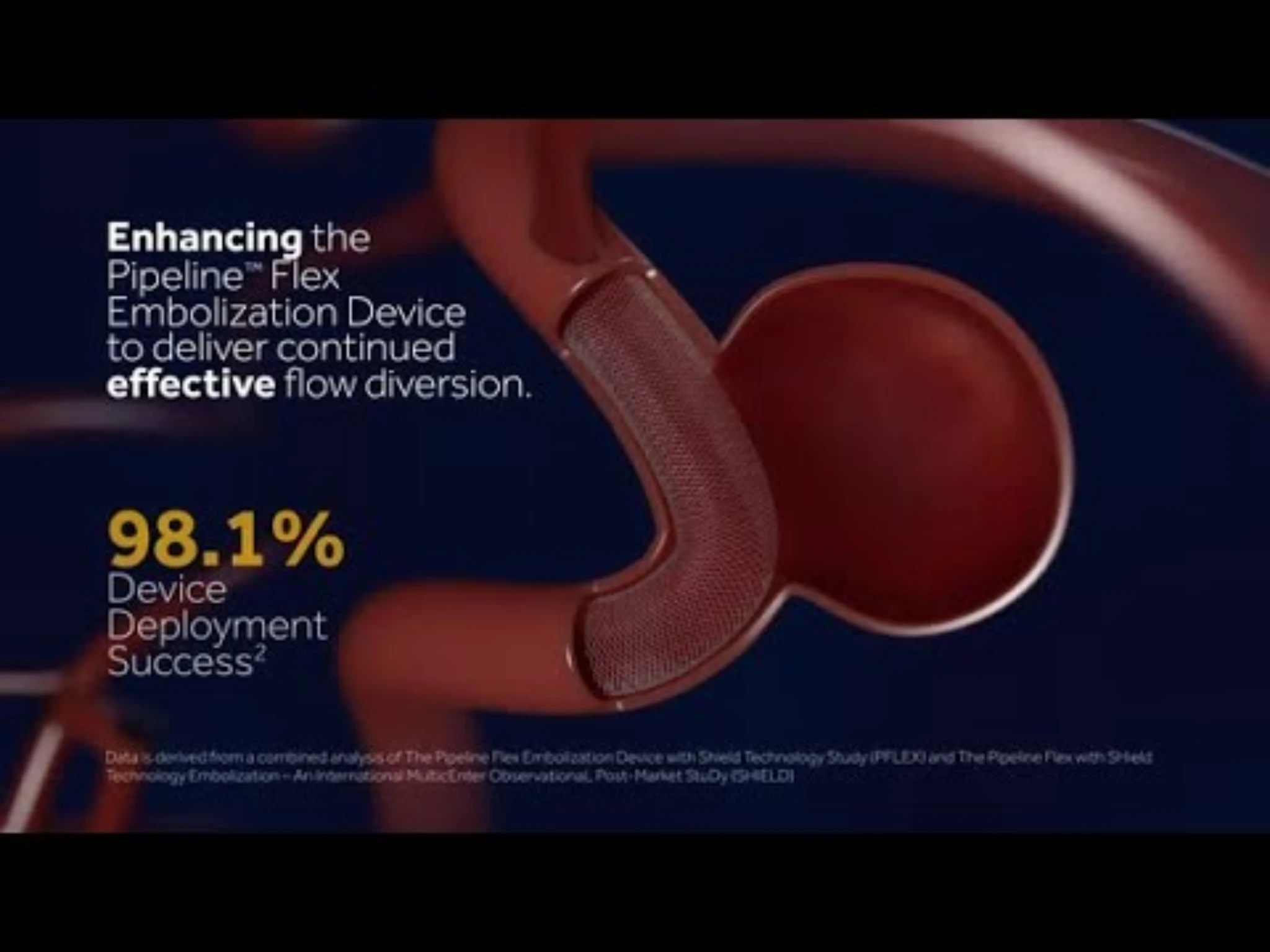 Pipeline Flex Embolization Device with Shield Technology