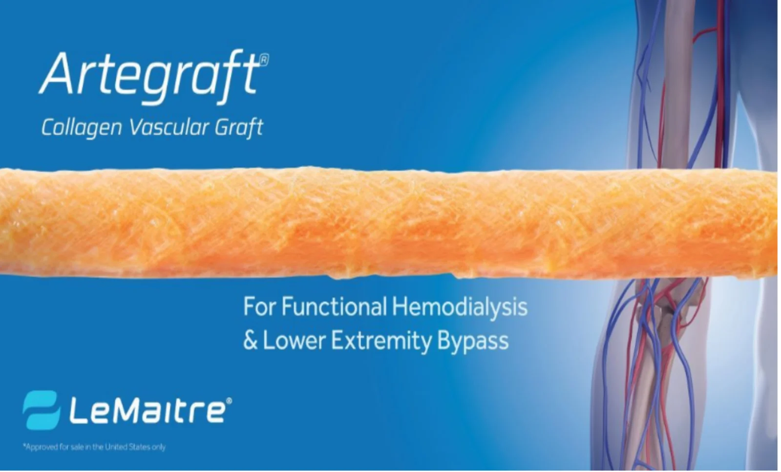 Artegraft Vascular Graft