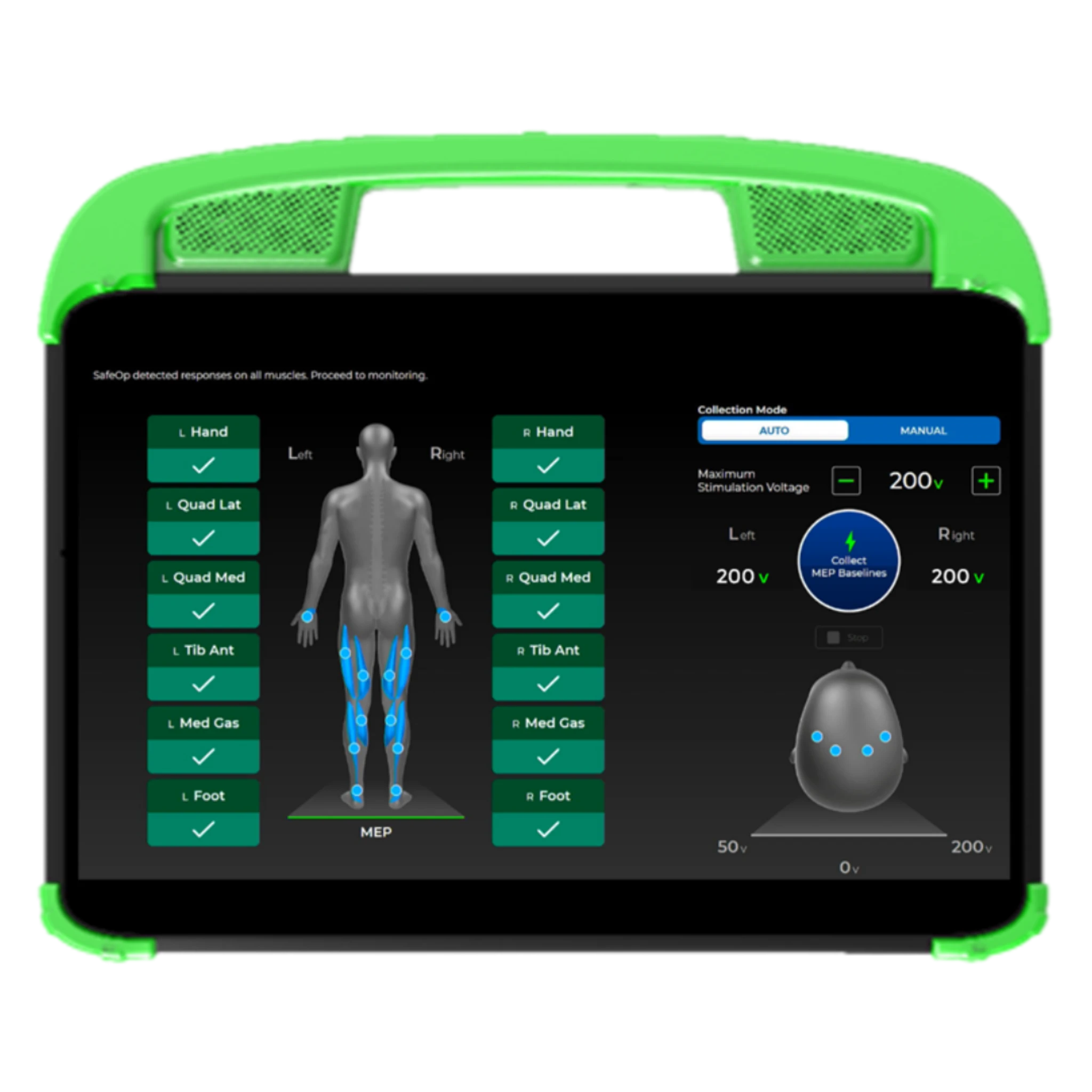 SafeOp Patient Interface