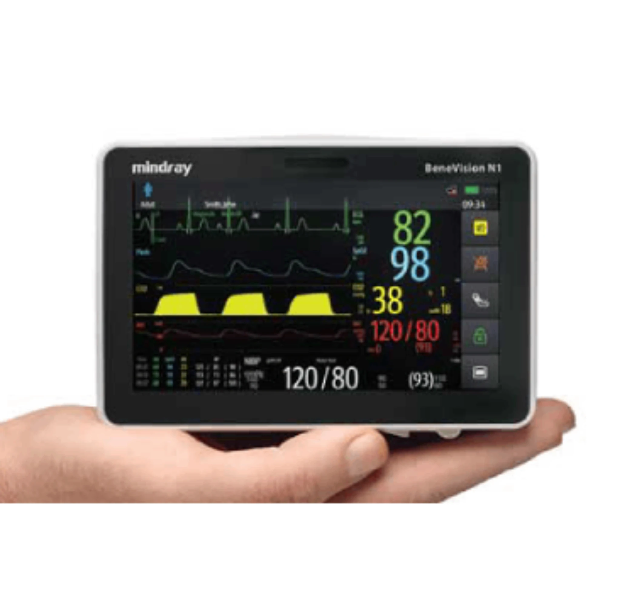 Mindray Patient Monitors and Telemetry Monitoring Systems